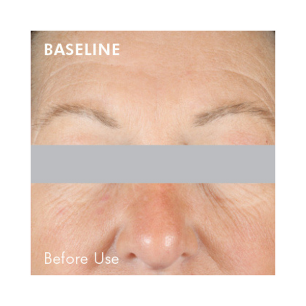 SkinCeuticals A.G.E. Interrupter Advanced