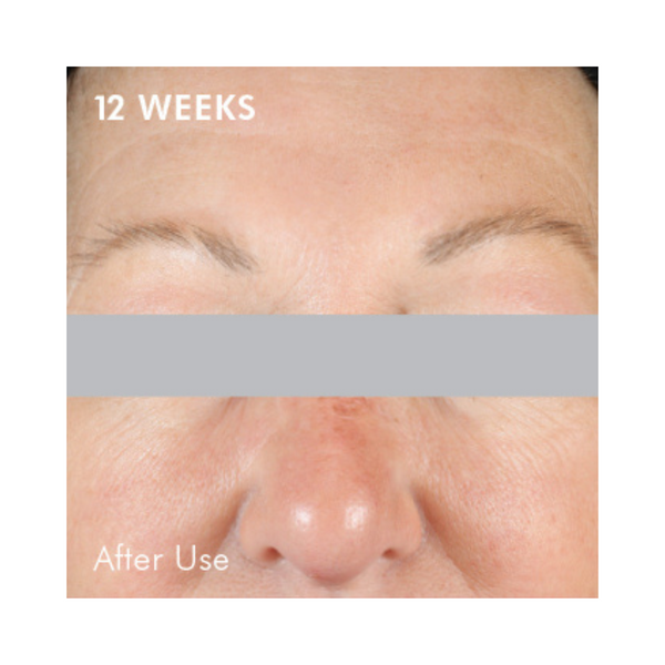 SkinCeuticals A.G.E. Interrupter Advanced